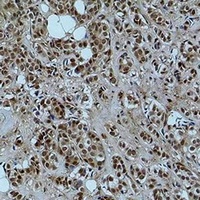 Histone H3 (Acetyl-K56) Rabbit Polyclonal Antibody
