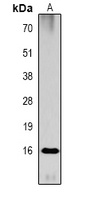 Histone H3 (Acetyl-K79) Rabbit Polyclonal Antibody
