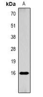Histone H3 (Acetyl-K9) Rabbit Polyclonal Antibody