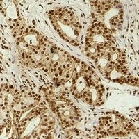 Histone H3 (Acetyl-K9) Rabbit Polyclonal Antibody