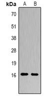Histone H3 (Citruline-R2+R8+R17) Rabbit Polyclonal Antibody