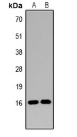 Histone H3 (DiMethyl-K14) Rabbit Polyclonal Antibody