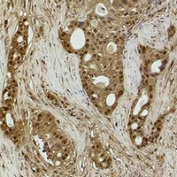 Histone H3 (DiMethyl-K14) Rabbit Polyclonal Antibody