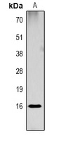Histone H3 (DiMethyl-K18) Rabbit Polyclonal Antibody