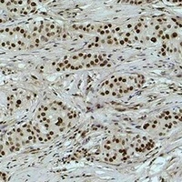 Histone H3 (DiMethyl-K18) Rabbit Polyclonal Antibody