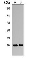Histone H3 (DiMethyl-K27) Rabbit Polyclonal Antibody