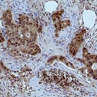 Histone H3 (DiMethyl-K27) Rabbit Polyclonal Antibody