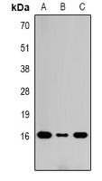 Histone H3 (DiMethyl-K36) Rabbit Polyclonal Antibody