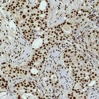 Histone H3 (DiMethyl-K36) Rabbit Polyclonal Antibody