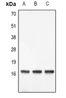 Histone H3 (DiMethyl-K4) Rabbit Polyclonal Antibody