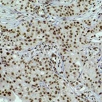 Histone H3 (DiMethyl-K4) Rabbit Polyclonal Antibody