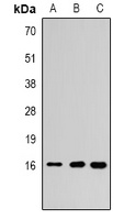 Histone H3 (DiMethyl-K79) Rabbit Polyclonal Antibody