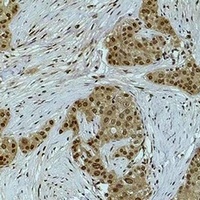 Histone H3 (DiMethyl-K79) Rabbit Polyclonal Antibody