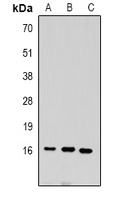 Histone H3 (DiMethyl-K9) Rabbit Polyclonal Antibody