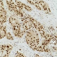 Histone H3 (DiMethyl-K9) Rabbit Polyclonal Antibody
