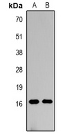 Histone H3 (MonoMethyl-K18) Rabbit Polyclonal Antibody