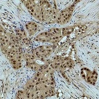 Histone H3 (MonoMethyl-K18) Rabbit Polyclonal Antibody