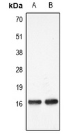 Histone H3 (MonoMethyl-K27) Rabbit Polyclonal Antibody