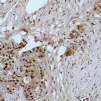 Histone H3 (MonoMethyl-K4) Rabbit Polyclonal Antibody