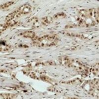 Histone H3 (MonoMethyl-R17) Rabbit Polyclonal Antibody