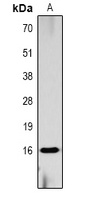 Histone H3 (Phospho-S10) Rabbit Polyclonal Antibody