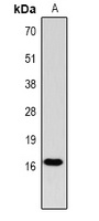 Histone H3 (Phospho-T11) Rabbit Polyclonal Antibody