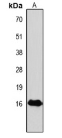 Histone H3 (Phospho-T118) Rabbit Polyclonal Antibody