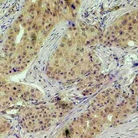 Histone H3 (Phospho-T118) Rabbit Polyclonal Antibody