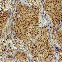 Histone H3 (Phospho-T32) Rabbit Polyclonal Antibody