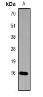 Histone H3 (Phospho-T45) Rabbit Polyclonal Antibody