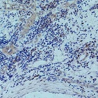 Histone H3 (Phospho-T45) Rabbit Polyclonal Antibody