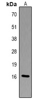 Histone H3 (Phospho-T6) Rabbit Polyclonal Antibody