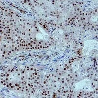 Histone H3 (Phospho-T6) Rabbit Polyclonal Antibody
