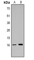 Histone H3 (TriMethyl-K14) Rabbit Polyclonal Antibody