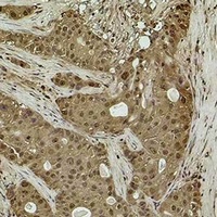 Histone H3 (TriMethyl-K14) Rabbit Polyclonal Antibody