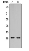 Histone H3 (TriMethyl-K18) Rabbit Polyclonal Antibody