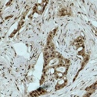 Histone H3 (TriMethyl-K18) Rabbit Polyclonal Antibody