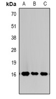 Histone H3 (TriMethyl-K27) Rabbit Polyclonal Antibody