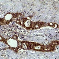Histone H3 (TriMethyl-K27) Rabbit Polyclonal Antibody
