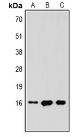 Histone H3 (TriMethyl-K36) Rabbit Polyclonal Antibody