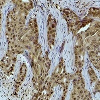 Histone H3 (TriMethyl-K36) Rabbit Polyclonal Antibody