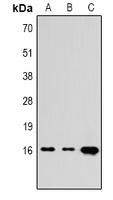 Histone H3 (TriMethyl-K4) Rabbit Polyclonal Antibody