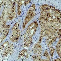 Histone H3 (TriMethyl-K4) Rabbit Polyclonal Antibody