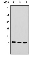 Histone H3 (TriMethyl-K79) Rabbit Polyclonal Antibody