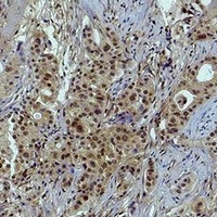 Histone H3 (TriMethyl-K79) Rabbit Polyclonal Antibody