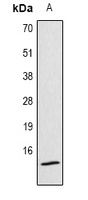 Histone H4 (Acetyl-K12) Rabbit Polyclonal Antibody