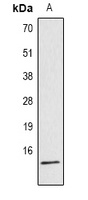 Histone H4 (Acetyl-K16) Rabbit Polyclonal Antibody