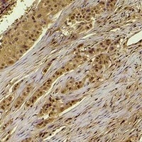 Histone H4 (Acetyl-K16) Rabbit Polyclonal Antibody