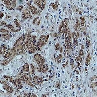 Histone H4 (Acetyl-K5) Rabbit Polyclonal Antibody