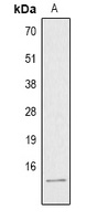 Histone H4 (Acetyl-K8) Rabbit Polyclonal Antibody